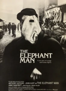 elephant_man_fr_wikicine_streaming_cinepedia